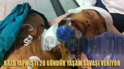 Kaza Yapmıştı 20 Gündür Yaşam Savaşı Veriyor