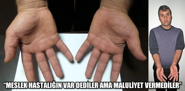 Meslek Hastası Diye İşine Son Verdiler fakat....