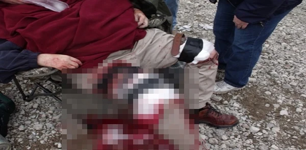 İnşaat'ta Spiral Motoru ile Bacağını Kesti