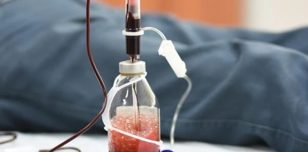 'Corona Virüs'e Karşı Ozon Terapisi Önerisi