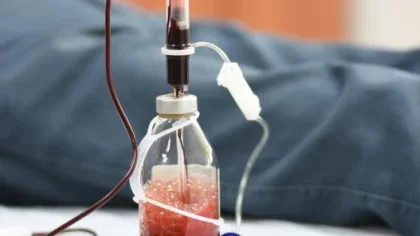 'Corona Virüs'e Karşı Ozon Terapisi Önerisi